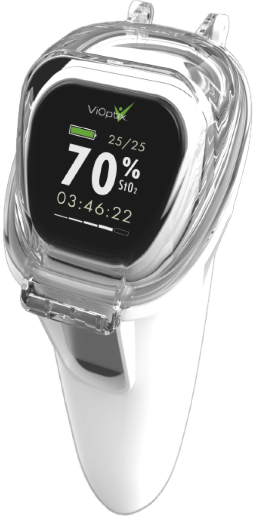 A clear oximeter displays 70% oxygen saturation and a heart rate of 25 BPM.